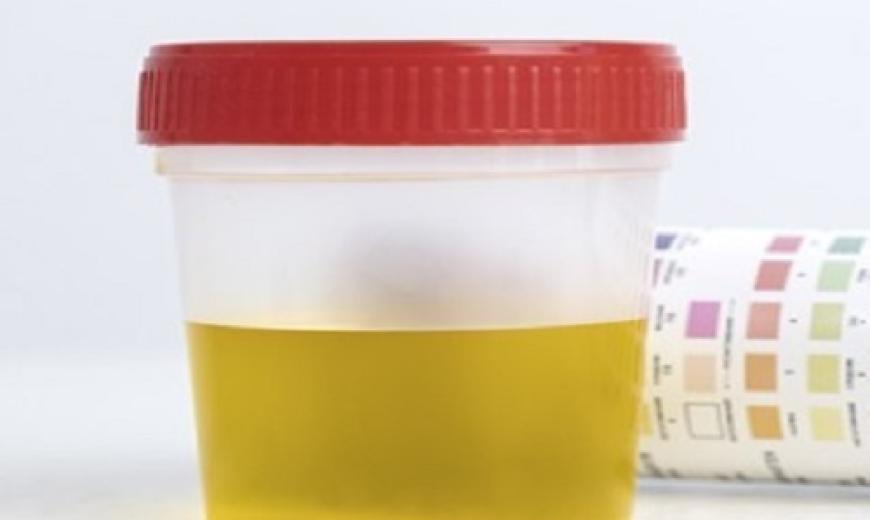 Urine