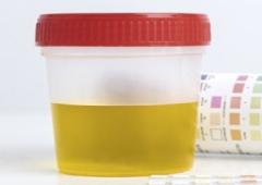 Urine
