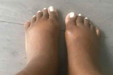 Grossesse