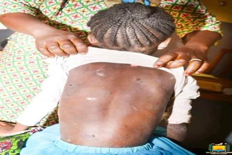 lutte contre toutes les formes de violence à l'encontre des personnes vulnérables