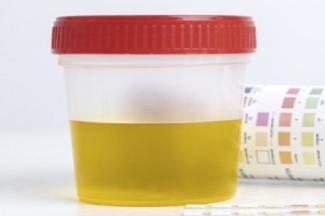 Urine