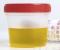 Urine